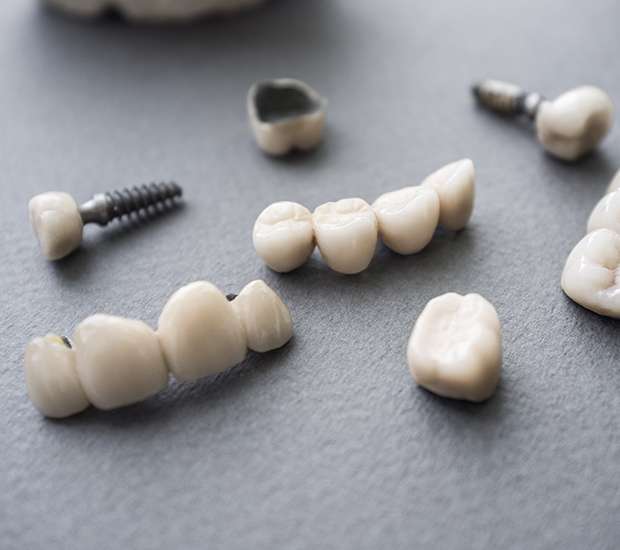 Fort Worth The Difference Between Dental Implants and Mini Dental Implants