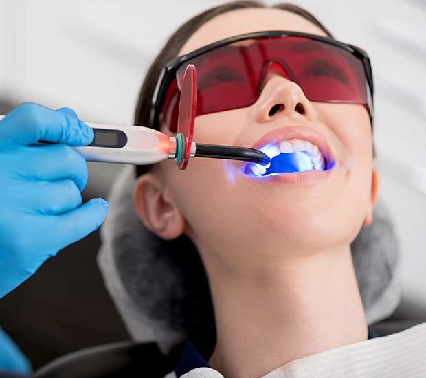 Fort Worth Professional Teeth Whitening