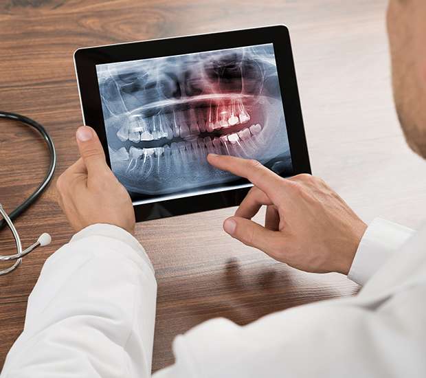 Fort Worth Types of Dental Root Fractures